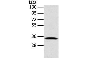 Western Blot analysis of Mouse lung tissue using STX11 Polyclonal Antibody at dilution of 1:400