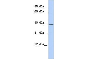 WB Suggested Anti-TMCC1 Antibody Titration:  0. (TMCC1 antibody  (Middle Region))