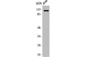 PPFIBP1 antibody  (Internal Region)