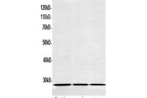 Western Blot analysis of Raji, Mouse spleen and Rat lung using CD27 Polyclonal Antibody at dilution of 1:600 (CD27 antibody)