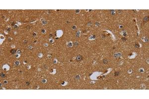 Immunohistochemistry of paraffin-embedded Human brain using PCK2 Polyclonal Antibody at dilution of 1:60 (PEPCK antibody)