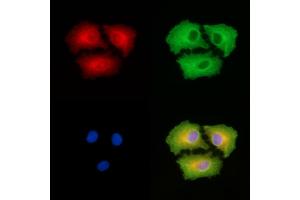 ABIN6265057 and ABIN6279818 staining  cells by IF/ICC.