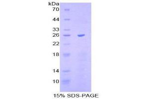 SDS-PAGE (SDS) image for SR-Related CTD-Associated Factor 11 (SCAF11) (AA 969-1165) protein (His tag) (ABIN2124244)