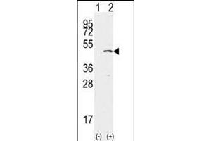 Western blot analysis of SET9(arrow) using rabbit polyclonal SET9 Antibody (ABIN387997 and ABIN2845289). (SETD7 antibody  (AA 159-189))