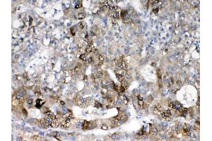 IHC analysis of Cytochrome P450 2D6 using anti- Cytochrome P450 2D6 antibody . (CYP2D6 antibody  (C-Term))