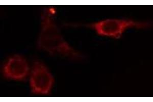 ABIN6275049 staining HuvEc cells by IF/ICC. (AGBL2 antibody  (C-Term))