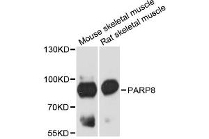 Western blot analysis of extracts of various cell lines, using PARP8 antibody. (PARP8 antibody)