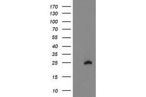 Western Blotting (WB) image for anti-Family With Sequence Similarity 119A (FAM119A) antibody (ABIN1498599) (FAM119A antibody)