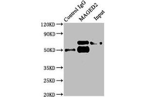 Immunoprecipitating MAGED2 in HepG2 whole cell lysate Lane 1: Rabbit control IgG instead of ABIN7159296 in HepG2 whole cell lysate. (MAGED2 antibody  (AA 38-285))