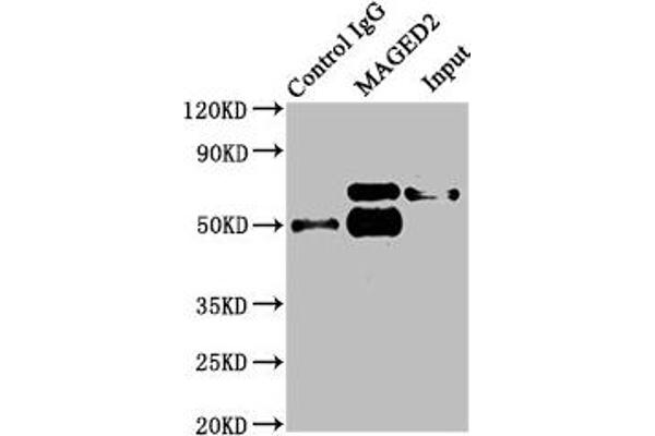 MAGED2 antibody  (AA 38-285)