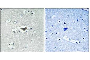 Immunohistochemical analysis of paraffin-embedded human brain tissue using Ras-GRF1 (Phospho-Ser916) antibody (left)or the same antibody preincubated with blocking peptide (right). (RASGRF1 antibody  (pSer916))