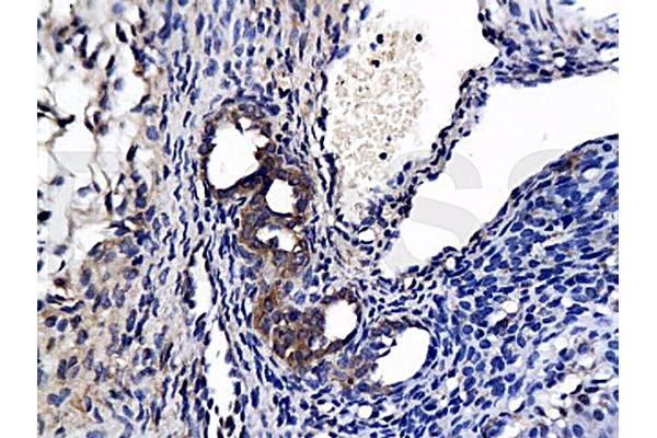 Apelin Receptor antibody  (AA 52-66)