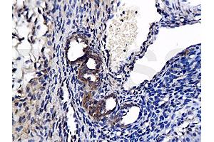 Formalin-fixed and paraffin-embedded : rat ovary tissue labeled with Rabbit Anti-APELIN RECEPTOR Polyclonal Antibody, Unconjugated (ABIN740160) 1:200 followed by conjugation to the secondary antibody and DAB staining