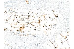 Immunohistochemistry (IHC) image for anti-CD36 (CD36) (AA 30-439) antibody (ABIN7449417) (Recombinant CD36 antibody  (AA 30-439))