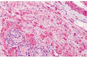 Human Prostate: Formalin-Fixed, Paraffin-Embedded (FFPE) (Vinculin antibody)
