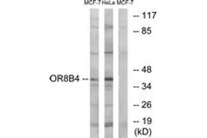 Western blot analysis of extracts from MCF-7/HeLa cells, using OR8B4 Antibody. (OR8B4 antibody  (AA 260-309))