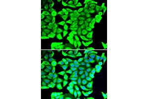 Immunofluorescence analysis of MCF-7 cells using DCD antibody.