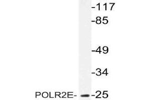 Western blot (WB) analysis of POLR2E antibody in extracts from MCF-7 cells.