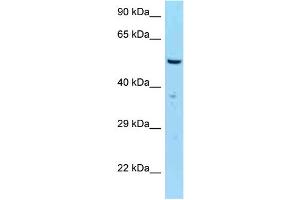 WB Suggested Anti-SASS6 Antibody Titration: 1. (SASS6 antibody  (C-Term))