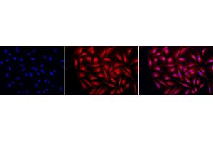 Immunocytochemistry/Immunofluorescence analysis using Rabbit Anti-GRP94 Polyclonal Antibody (ABIN1686652 and ABIN1686653). (GRP94 antibody  (C-Term))
