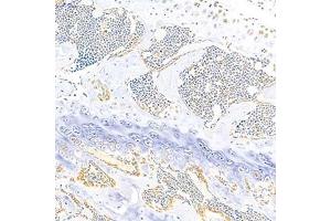 Immunohistochemistry analysis of paraffin-embedded mouse bone using Eif2ak1 (ABIN7073875) at dilution of 1: 1000