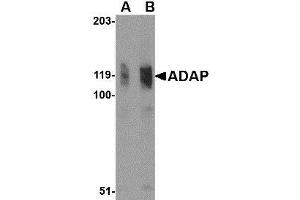 Western blot analysis of ADAP in K562 cell lysate with AP30020PU-N ADAP antibody at (A) 0. (FYB antibody  (N-Term))