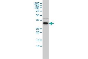 RNASEH2A monoclonal antibody (M01), clone 3G5-F5 Western Blot analysis of RNASEH2A expression in Jurkat . (RNASEH2A antibody  (AA 1-299))