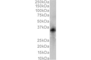 Western Blot using anti-CD79b antibody HM79-16. (Recombinant CD79b antibody)
