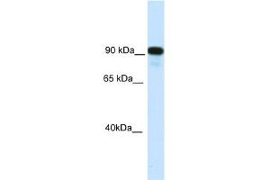 WB Suggested Anti-C2TA Antibody Titration:  0. (CIITA antibody  (C-Term))