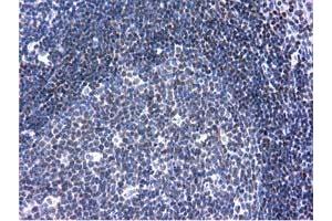 Immunohistochemical staining of paraffin-embedded Human lymph node tissue using anti-ANKRD53 mouse monoclonal antibody. (ANKRD53 antibody  (AA 1-300))