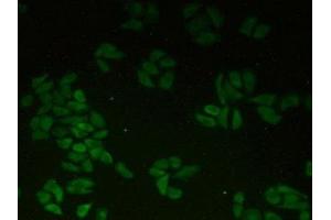 Detection of CTNNa1 in Human Hela Cells using Polyclonal Antibody to Catenin Alpha 1 (CTNNa1) (CTNNA1 antibody  (AA 2-228))