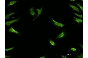 Immunofluorescence of monoclonal antibody to RBP7 on HeLa cell. (RBP7 antibody  (AA 35-134))