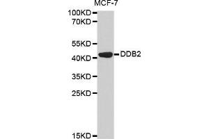 Western blot analysis of extracts of MCF-7 cell line, using DDB2 antibody. (DDB2 antibody  (AA 1-315))