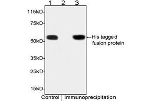 Image no. 6 for anti-His Tag antibody (ABIN300028)