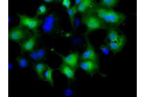 Anti-CRYM mouse monoclonal antibody (ABIN2452922) immunofluorescent staining of COS7 cells transiently transfected by pCMV6-ENTRY CRYM (RC218123). (CRYM antibody)
