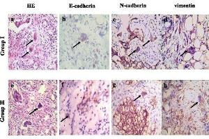 Immunohistochemistry (IHC) image for anti-Cadherin 1, Type 1, E-Cadherin (Epithelial) (CDH1) (AA 401-500) antibody (ABIN1387847)