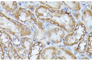 Immunohistochemistry of paraffin-embedded Rat kidney using HAL Polyclonal Antibody at dilution of 1:100 (40x lens). (HAL antibody)