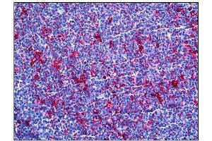 Immunohistochemistry (IHC) image for anti-Gelsolin (GSN) antibody (ABIN781885) (Gelsolin antibody)