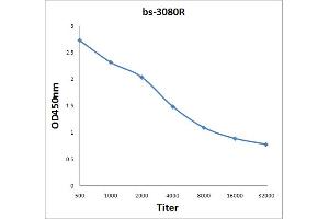 Antigen: 2 µg/100 µL  Primary: Antiserum, 1:500, 1:1000, 1:2000, 1:4000, 1:8000, 1:16000, 1:32000;  Secondary: HRP conjugated Rabbit Anti-Goat IgG at 1: 5000;  TMB staining Read the data in Microplate Reader by 450nm. (CYLD antibody  (pSer418))