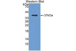 Western Blotting (WB) image for anti-Nuclear Factor-kB p65 (NFkBP65) (AA 19-306) antibody (ABIN1863094) (NF-kB p65 antibody  (AA 19-306))