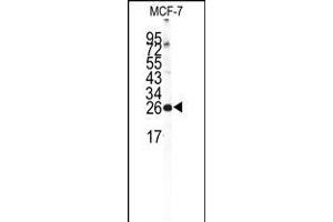 Western blot analysis of NCS1 Antibody in MCF-7 cell line lysates (35ug/lane) (NCS1 antibody  (AA 118-144))