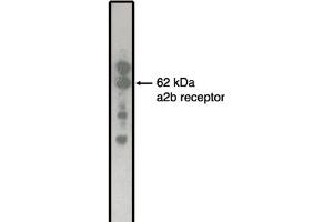 Western Blotting (WB) image for anti-Adrenergic, alpha-2B-, Receptor (ADRA2B) antibody (ABIN264463) (ADRA2B antibody)