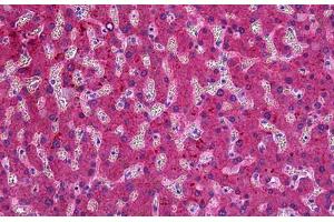 Human Liver: Formalin-Fixed, Paraffin-Embedded (FFPE) (ITIH4 antibody  (AA 744-758))