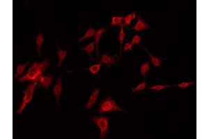 ABIN6274416 staining Hela by IF/ICC. (AKAP14 antibody  (N-Term))