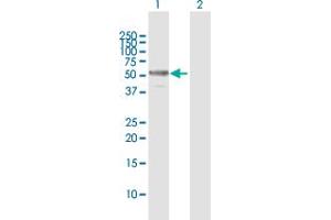 Western Blot analysis of CFLAR expression in transfected 293T cell line by CFLAR MaxPab polyclonal antibody. (FLIP antibody  (AA 1-480))