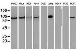 Image no. 1 for anti-Transforming, Acidic Coiled-Coil Containing Protein 3 (TACC3) antibody (ABIN1498095) (TACC3 antibody)