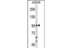 Western blot analysis in A2058 cell line lysates (35ug/lane). (E2F7 antibody  (AA 591-619))
