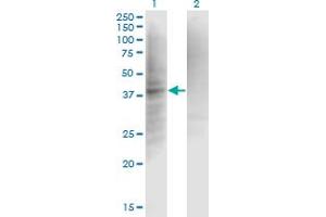 Western Blot analysis of CFI expression in transfected 293T cell line by IF monoclonal antibody (M01), clone 1B3. (Complement Factor I antibody  (AA 19-118))