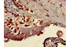 Immunohistochemistry of paraffin-embedded human placenta tissue using ABIN7171919 at dilution of 1:100 (TTC27 antibody  (AA 590-817))