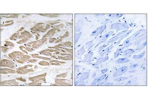 Immunohistochemistry analysis of paraffin-embedded human heart tissue using BRP44L antibody. (BRP44L antibody  (N-Term))